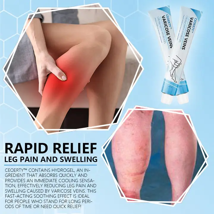 Varicose Veins Cream with Hydrogel - Image 2