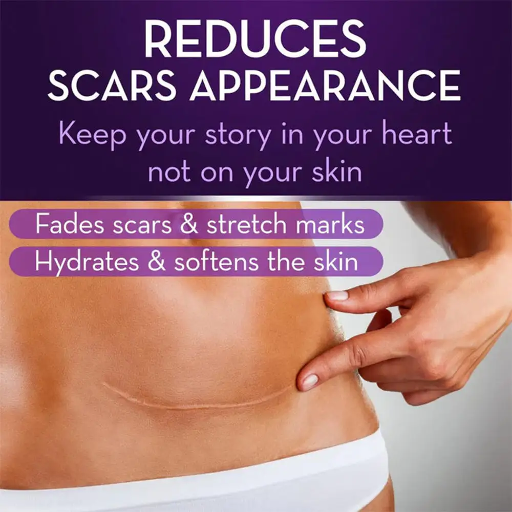 Stem Cell Scar Gel - Image 6