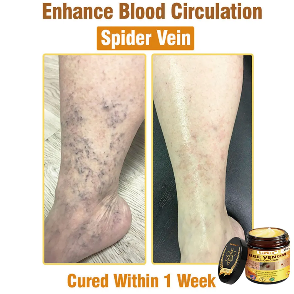 Bee Venom All-in-One Cream US Dermatologist Approved - Image 4