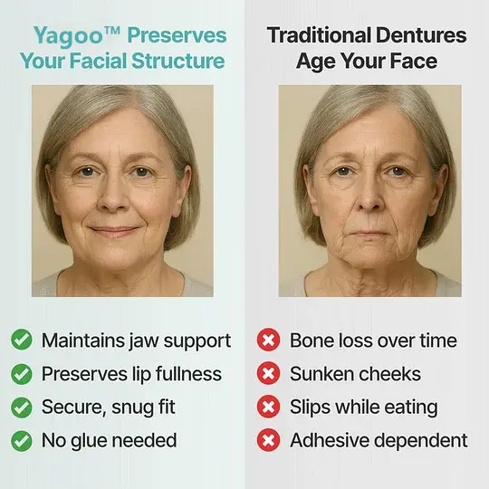 Custom-Fit Full Functional Dentures - Image 5