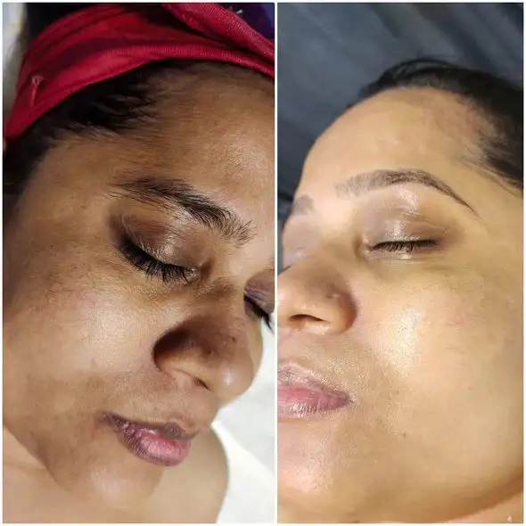 Melanin Correcting Facial Serum - Image 4