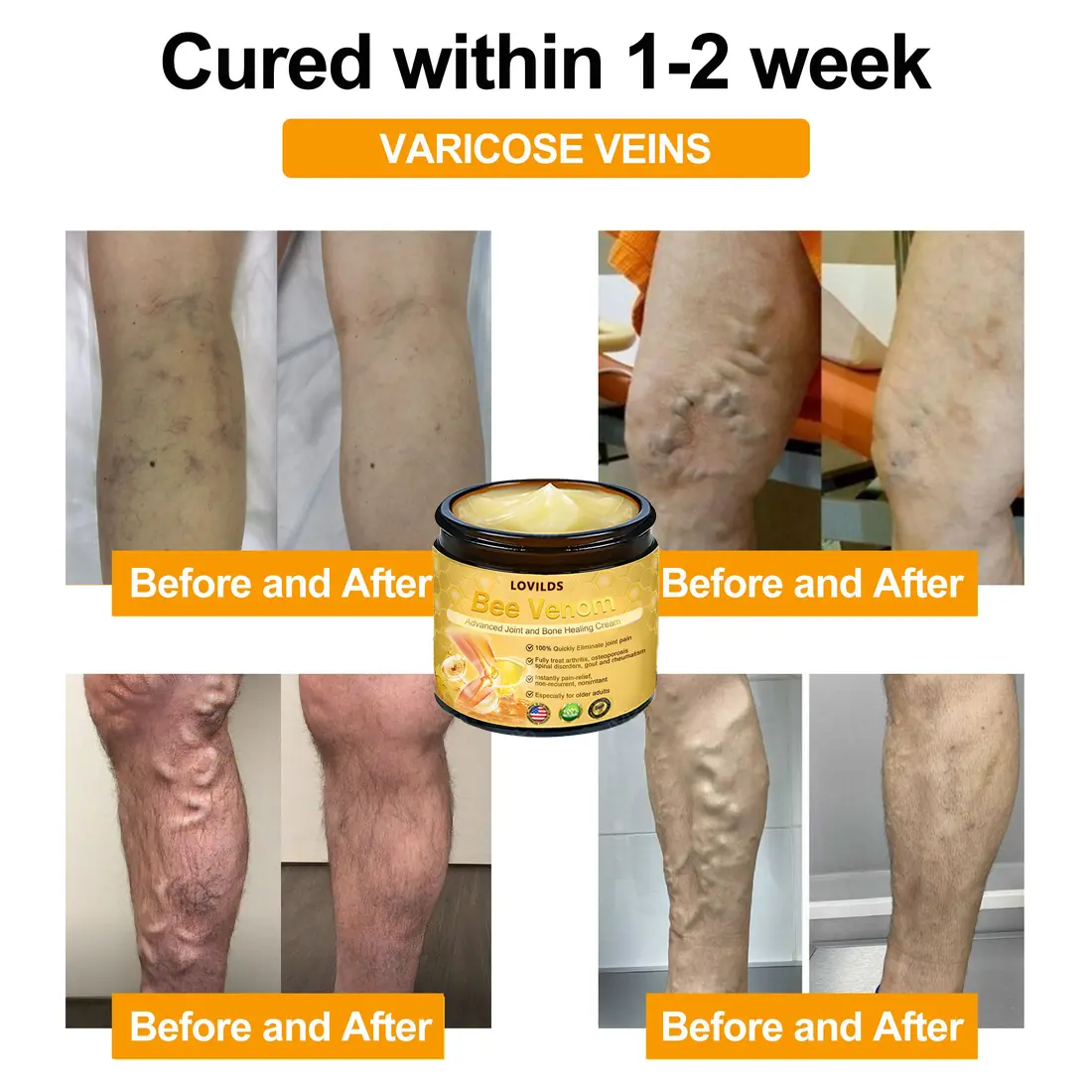 LOVILDS Bee Venom Advanced Joint and Bone Healing Cream - Image 7