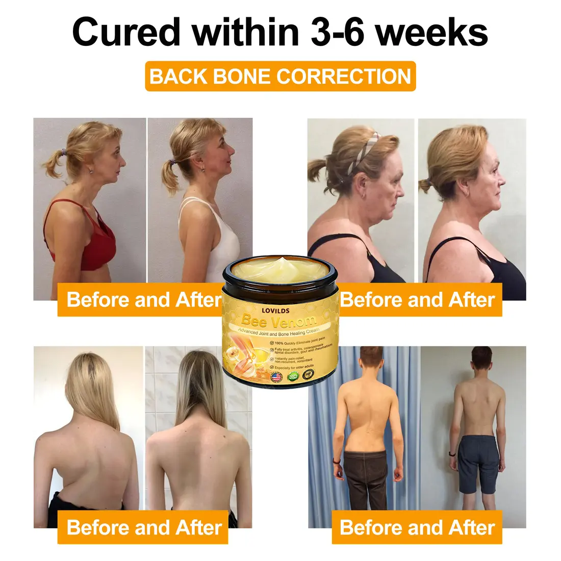 LOVILDS Bee Venom Advanced Joint and Bone Healing Cream - Image 8