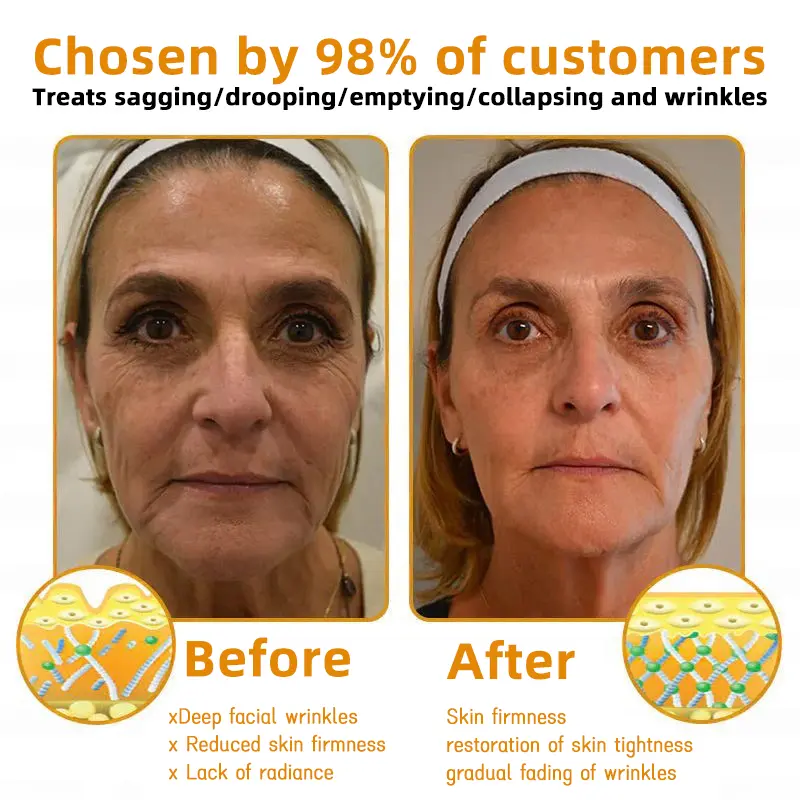 Bee Venom Skin Restoration Cream - Image 10