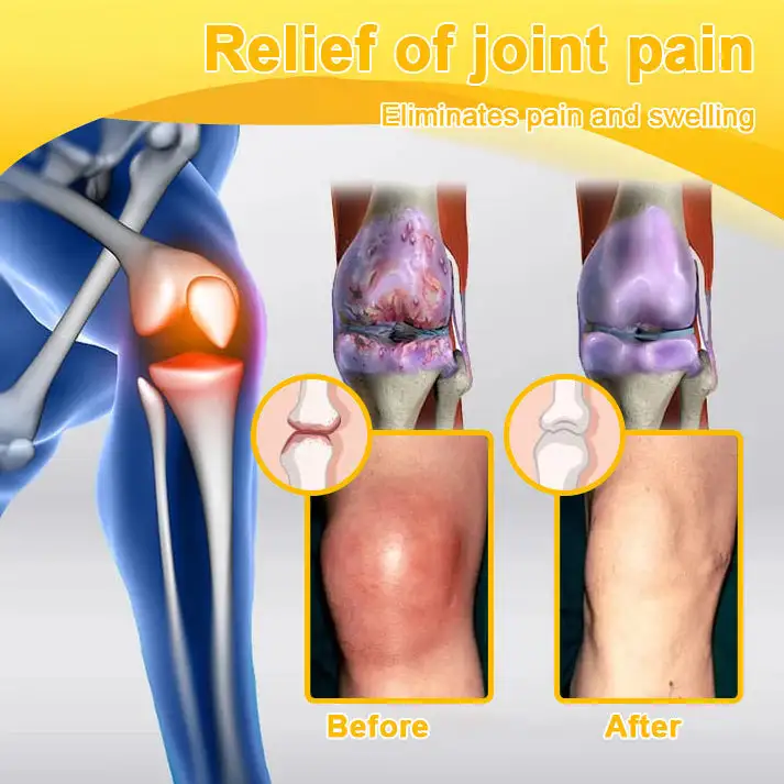 Botulinum Toxin & Bee Venom Pain-Relief Bone Healing Cream - Image 9