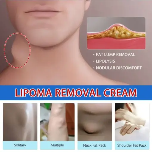 LIPOMA CREAM - Image 4