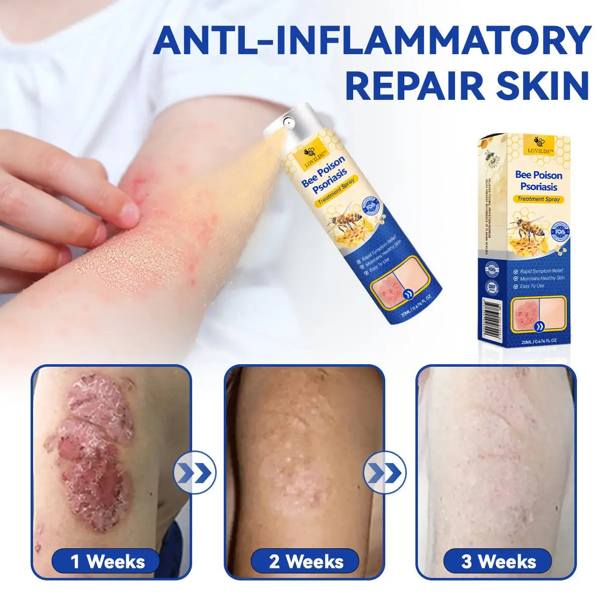 PsoriaHeal psoriasis Spray pro - Image 8