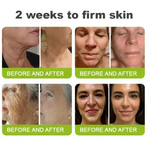 Skin Tightening Vita-A Retinol Retinol shot Anti-Wrinkle Firming Tightening cream - Image 7