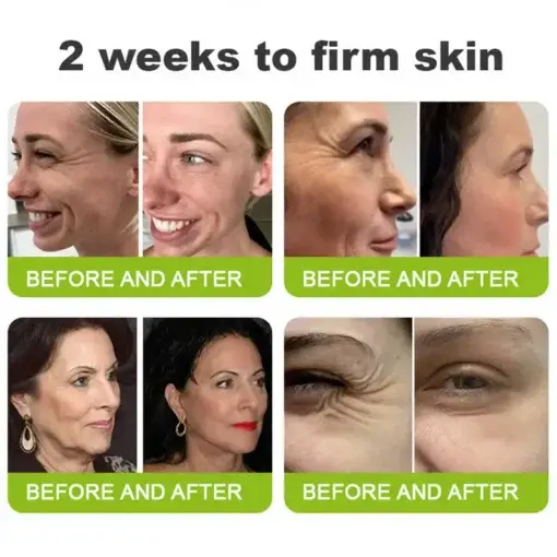 Skin Tightening Vita-A Retinol Retinol shot Anti-Wrinkle Firming Tightening cream – Last Day Promotion 70 OFF - Image 6