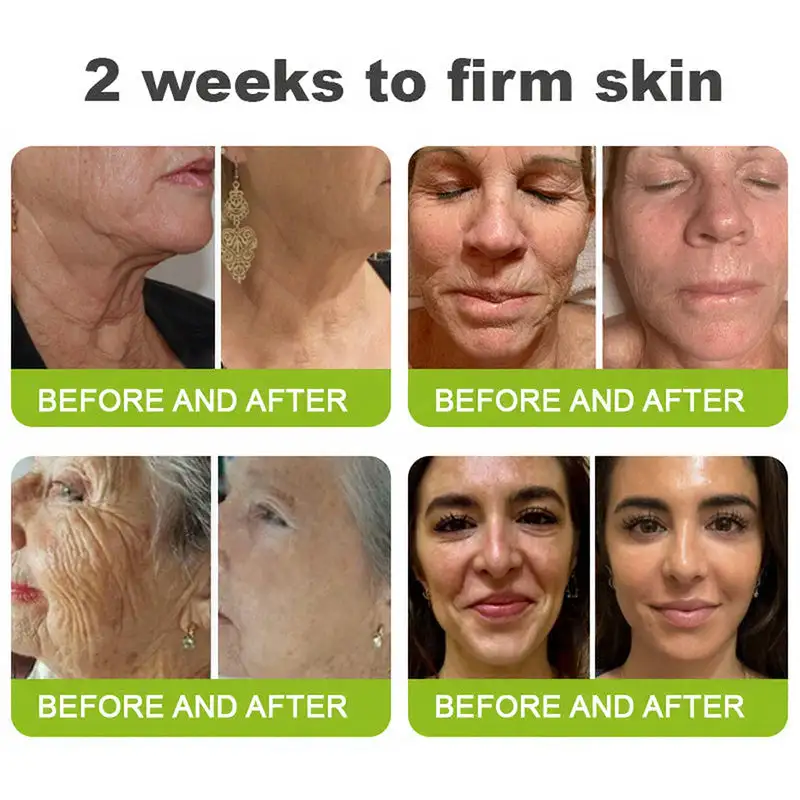 Wrinkle-Lift Tightening Cream | See firmer, smoother skin in as little as 3 days - Image 7