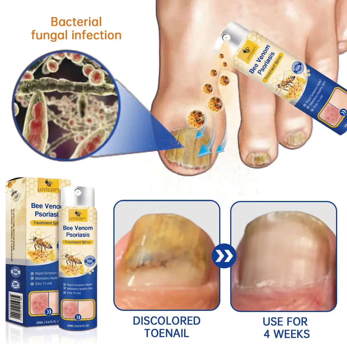 PsoriaHeal psoriasis Spray - Image 7