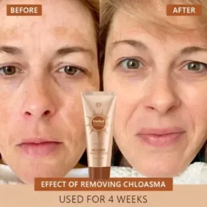 Alternative view of Whitening and Spot-Removing Face Mask Suitable for face and body