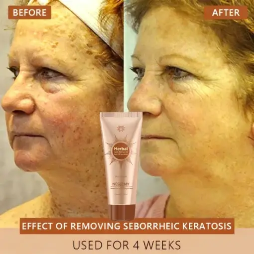 Whitening and Spot-Removing Face Mask Suitable for face and body - Image 3