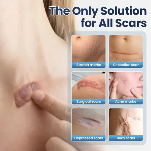 DERMALUX Texture Repair Gel - Image 2