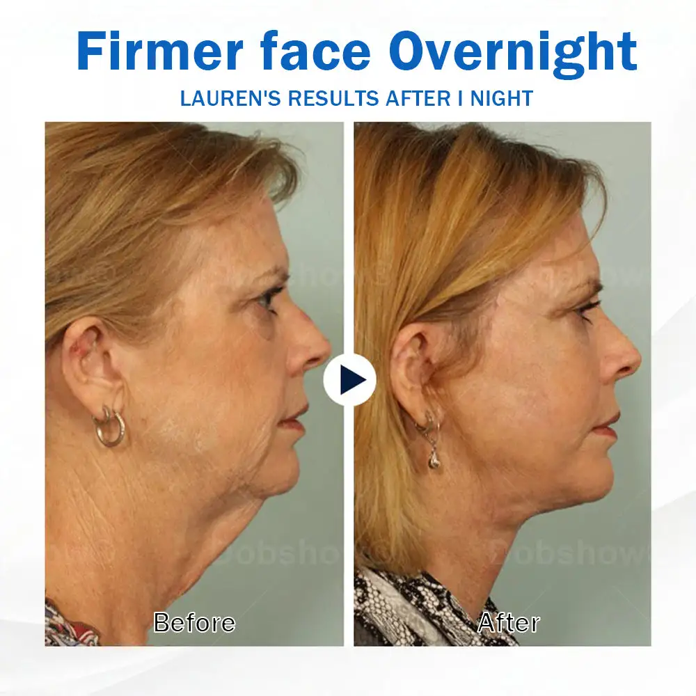 Sleeping V-Face Beauty Device - Image 8