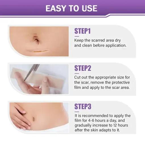 Hyaluronic Acid Nano Microneedle Repair Tape - Image 5
