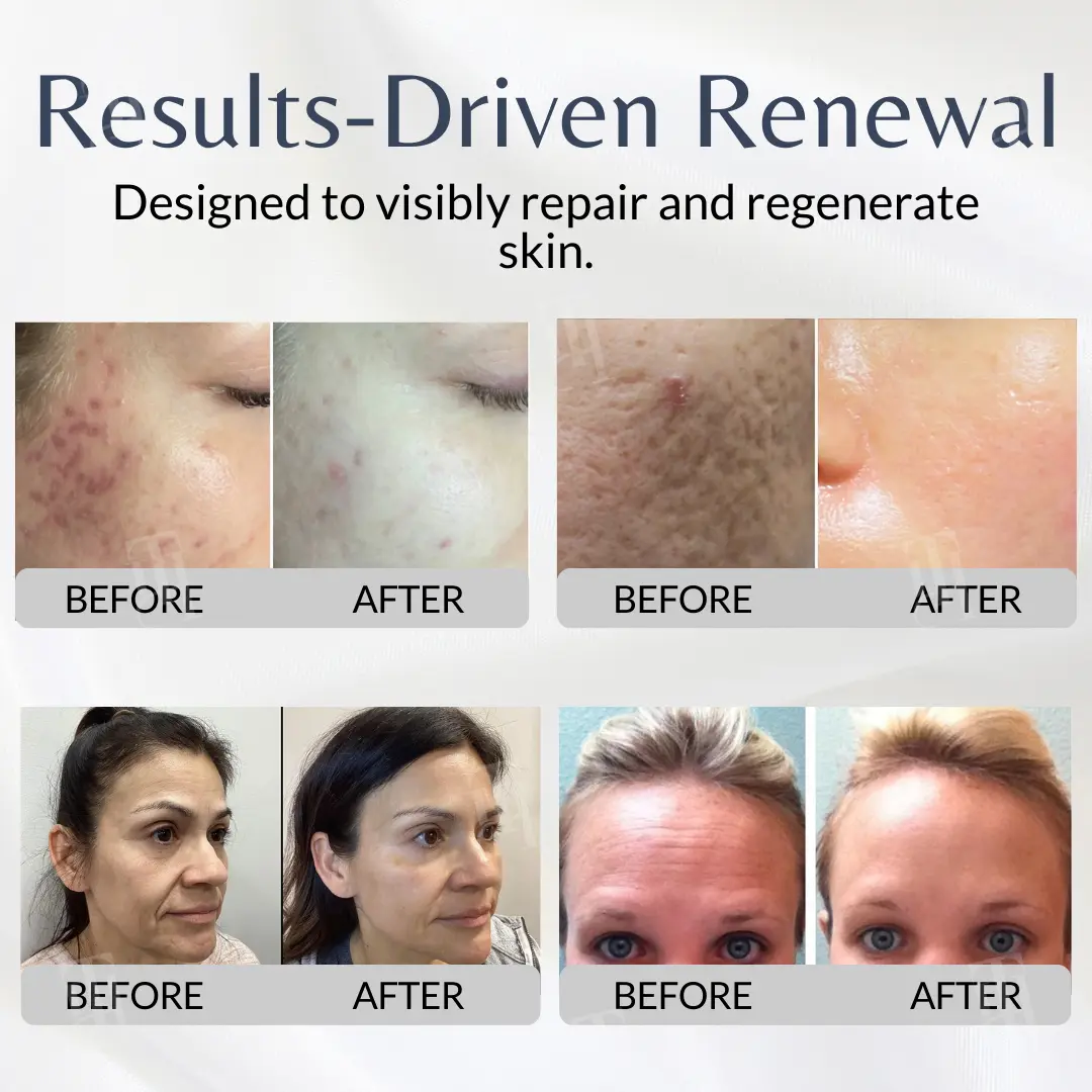 Cellular Renewal System. - Image 2