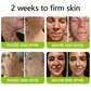 BOTOX & VITA A RETINOL SHOT Wrinkle Lift Tightening Cream - Image 28