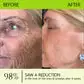BOTOX & VITA A RETINOL SHOT Wrinkle Lift Tightening Cream - Image 34