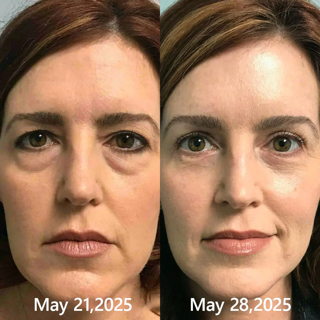 BOTOX & VITA A RETINOL SHOT Wrinkle Lift Tightening Cream - Image 40