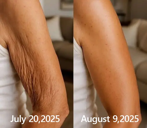BOTOX & VITA A RETINOL SHOT Wrinkle Lift Tightening Cream - Image 42