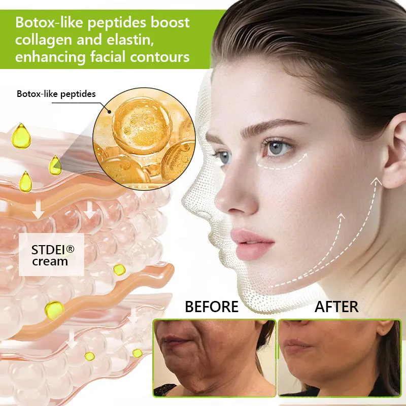 BOTOX & VITA A RETINOL SHOT Wrinkle Lift Tightening Cream - Image 49