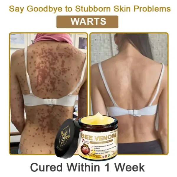 Botox Bee Venom Skin Treatment Cream - Image 9