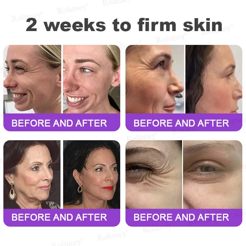 NAD+ Retinol Firming & Lifting Cream - Image 3