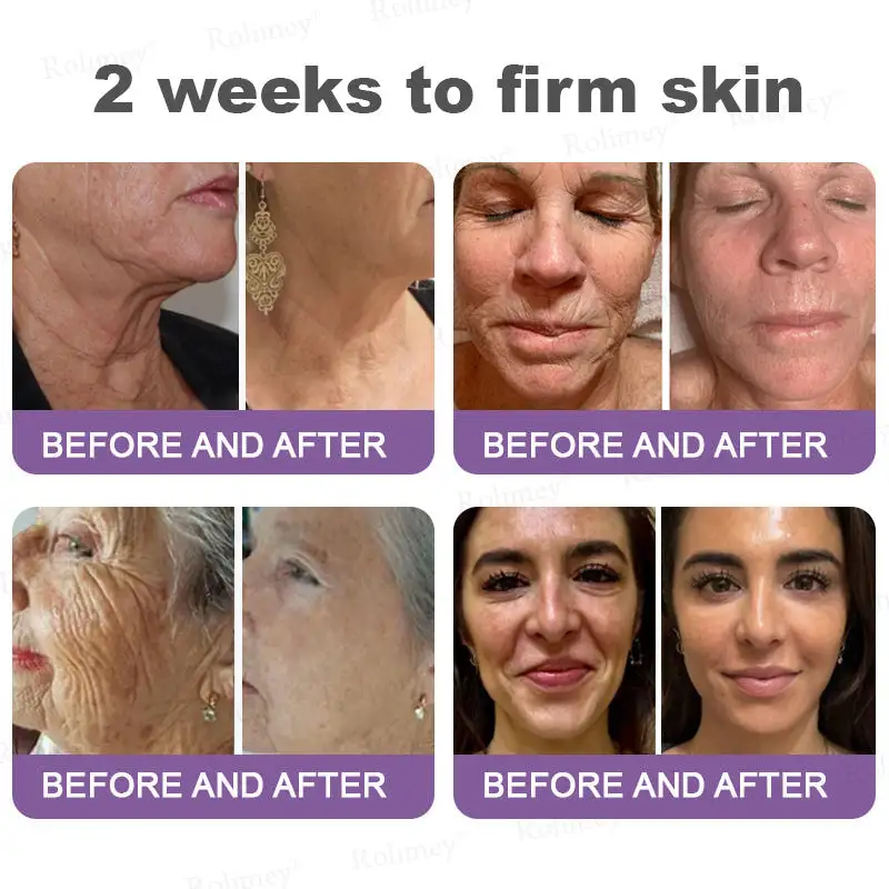 NAD+ Retinol Firming & Lifting Cream - Image 4