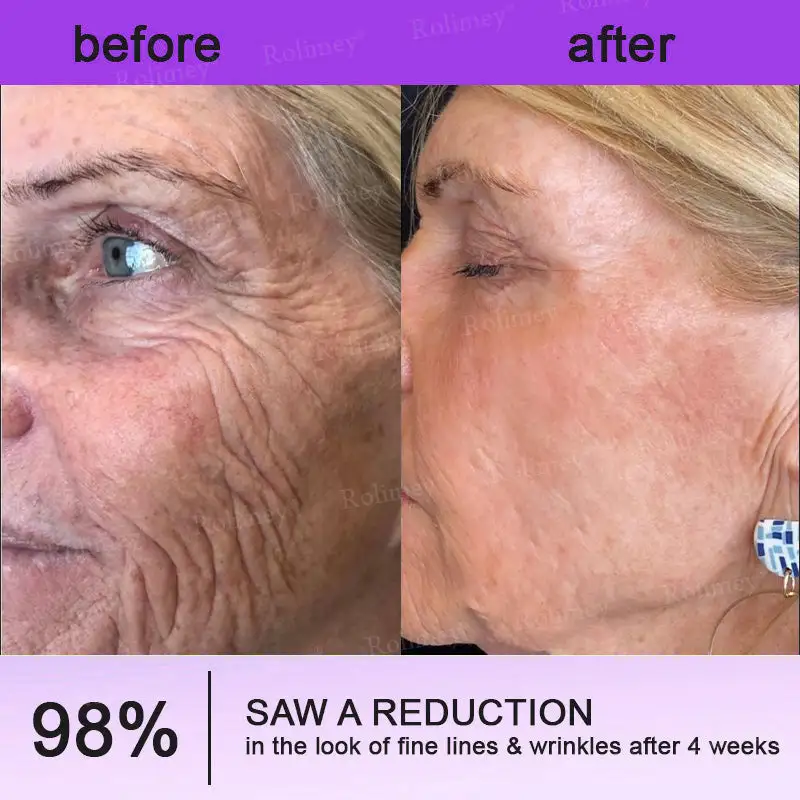 NAD+ Retinol Firming & Lifting Cream - Image 6