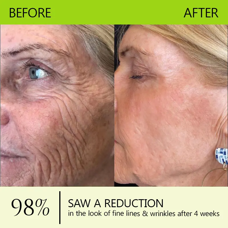 Botox & Vitamin A Retinol Shot Anti-Wrinkle Firming Cream - Image 11