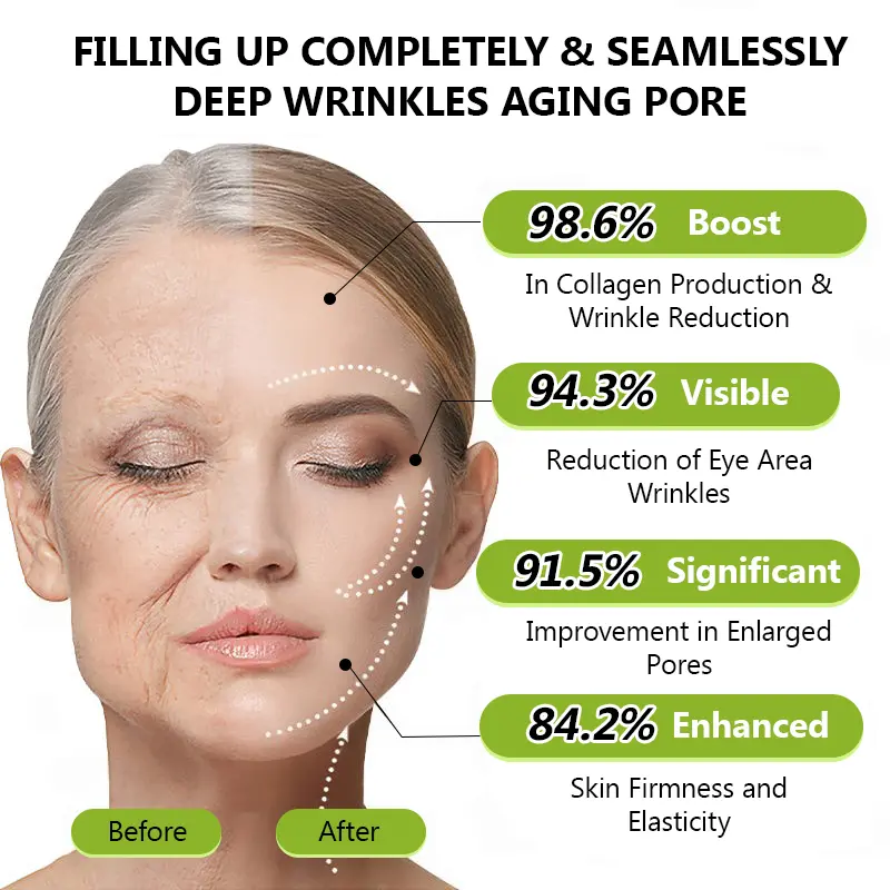 Botox & Vitamin A Retinol Shot Anti-Wrinkle Firming Cream - Image 12