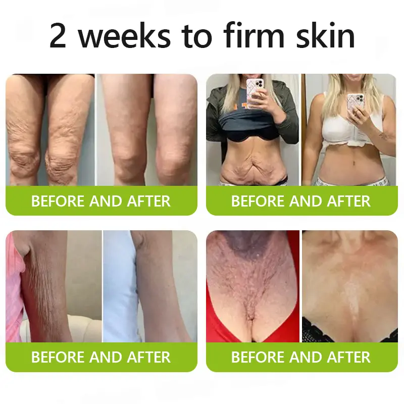 Botox & Vitamin A Retinol Shot Anti-Wrinkle Firming Cream - Image 5