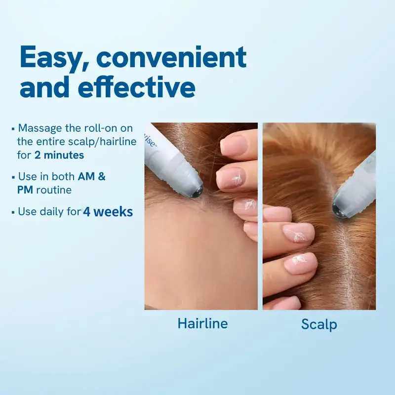 Professional Anti-Hair Loss Roll-On - Image 3
