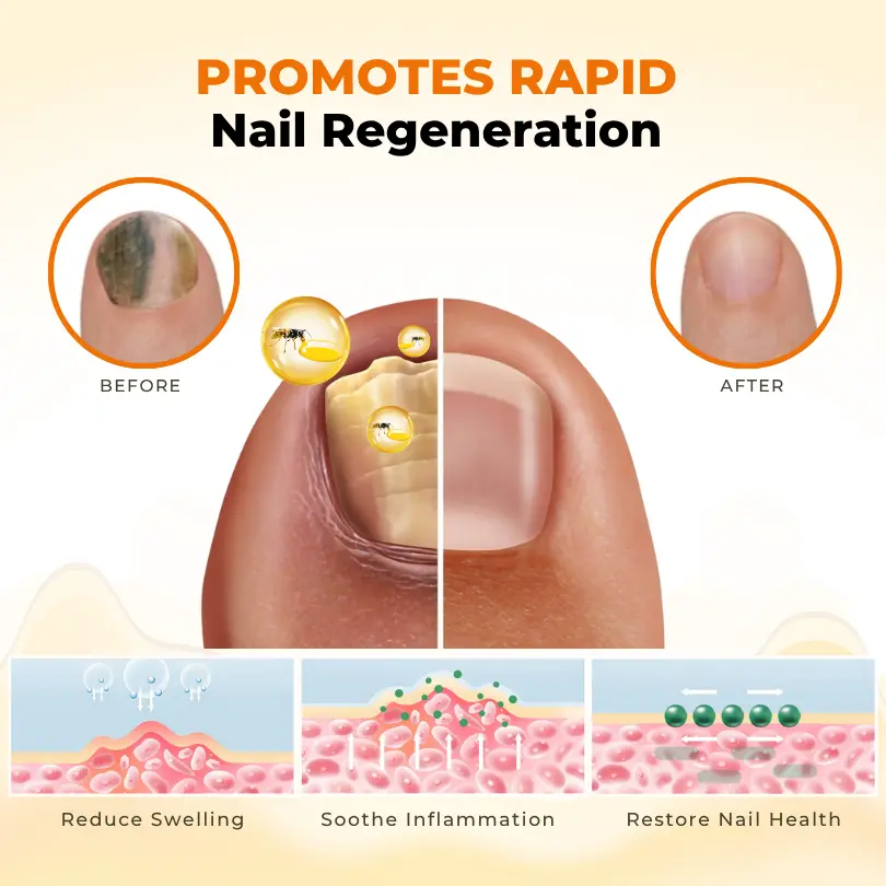 NailRevive Bee Venom Anti-fungi Solution - Image 4