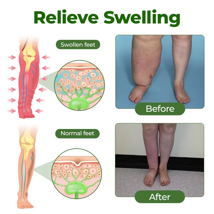 Professional Leg Circulation Cream - Image 4
