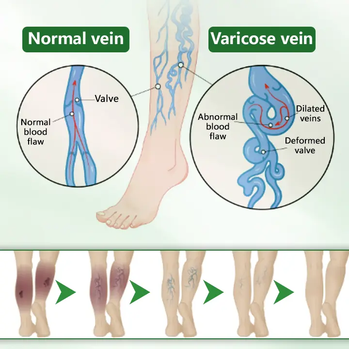 VeinFlex Magnesium Relief Spray - Image 5