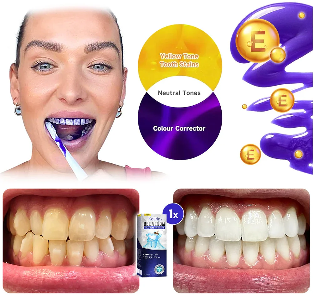 Kolirin Bee Venom Treatment Toothpaste - Image 11