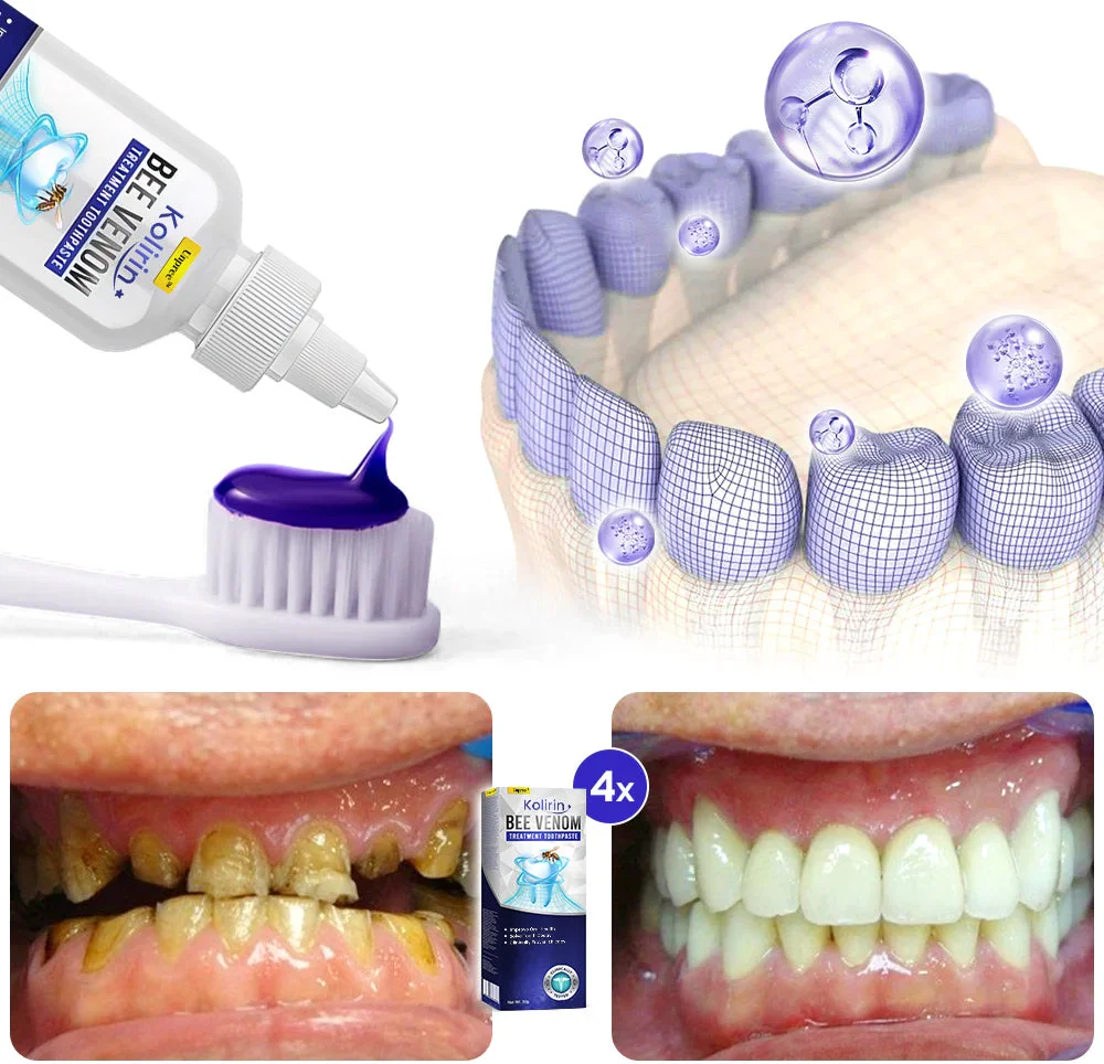 Kolirin Bee Venom Treatment Toothpaste - Image 12