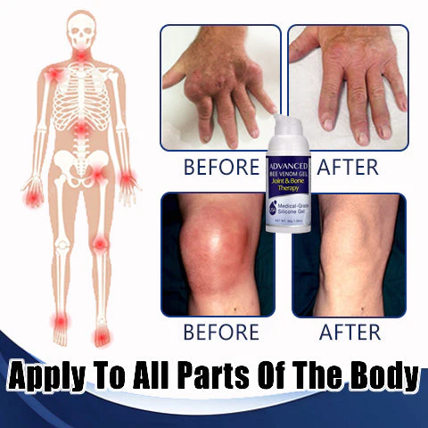 Advanced Joint & Bone Therapy Bee Venom Gel - Image 2