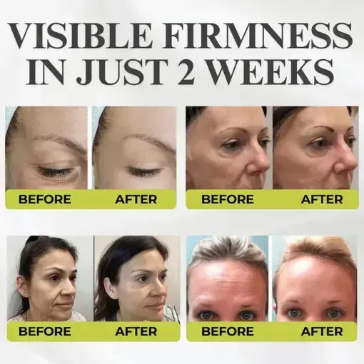 Botox Vita-A Retinol Shot Wrinkle-Lift Tightening cream - Image 2