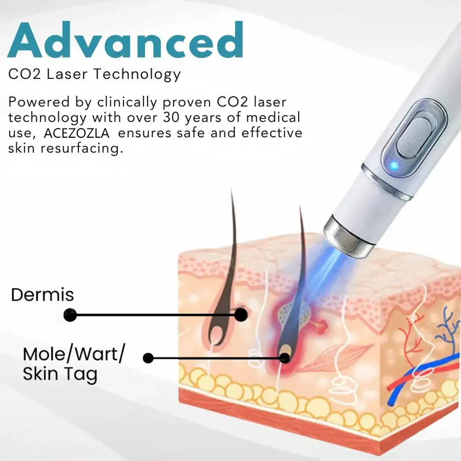 non-invasive laser pen delivers hospital-grade results at home - Image 7