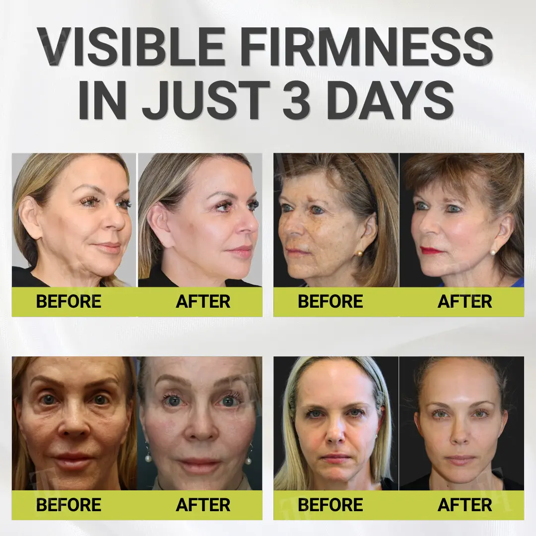 Botox & Vita-A Retinol Shot Wrinkle - Lift Tightening Cream - Image 4