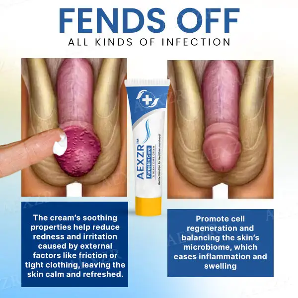 Foreskin Cure & Glans Care Cream - Image 4