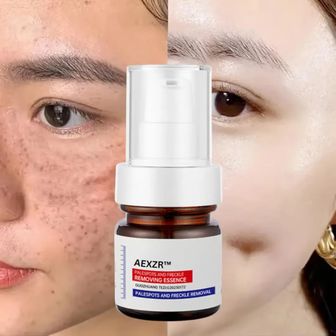Vitamin C Whitening Freckles Face Cream Remove Melasma Dark Spots Lighten Melanin - Image 12