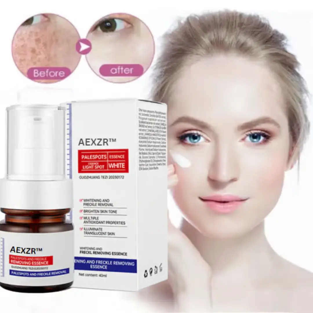 Vitamin C Whitening Freckles Face Cream Remove Melasma Dark Spots Lighten Melanin - Image 13
