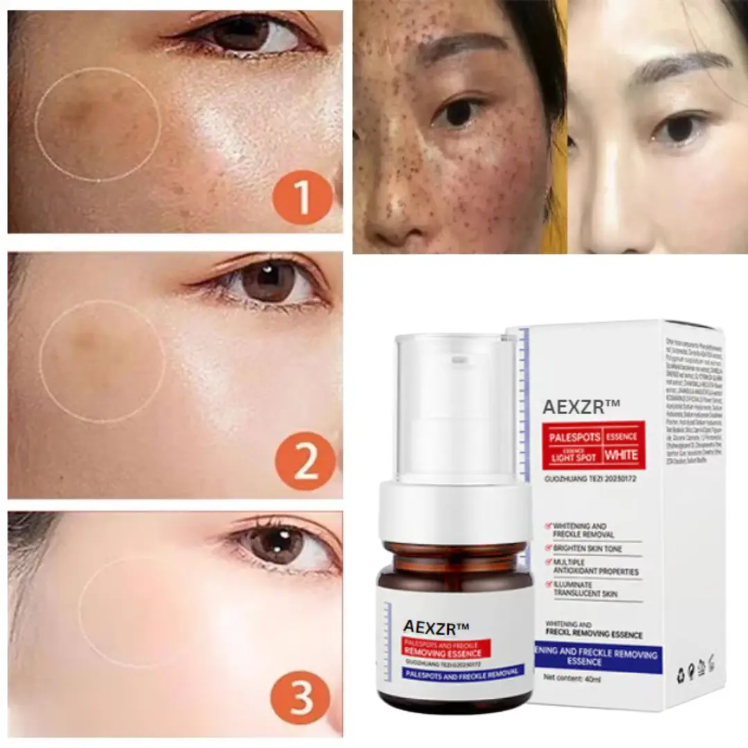 Vitamin C Whitening Freckles Face Cream Remove Melasma Dark Spots Lighten Melanin - Image 15