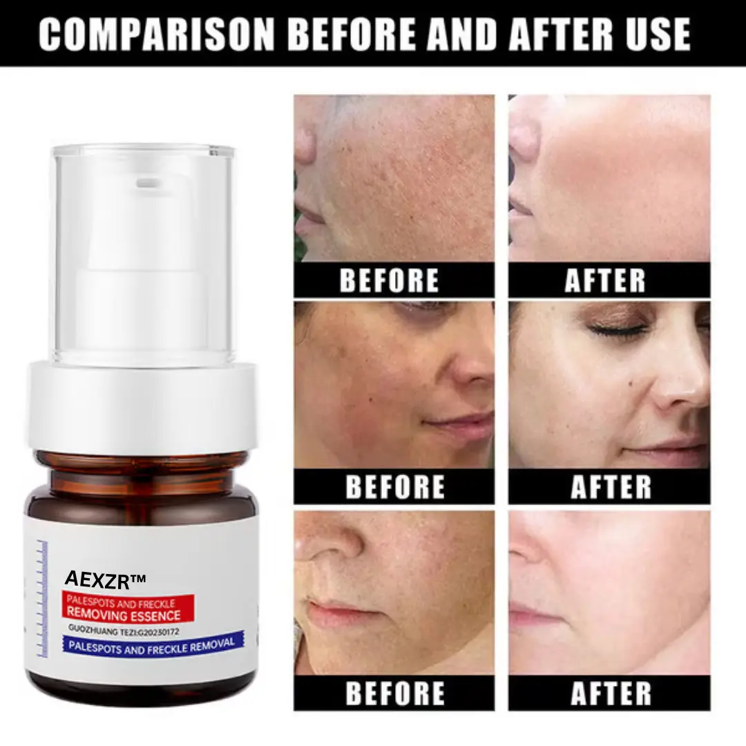 Vitamin C Whitening Freckles Face Cream Remove Melasma Dark Spots Lighten Melanin - Image 5
