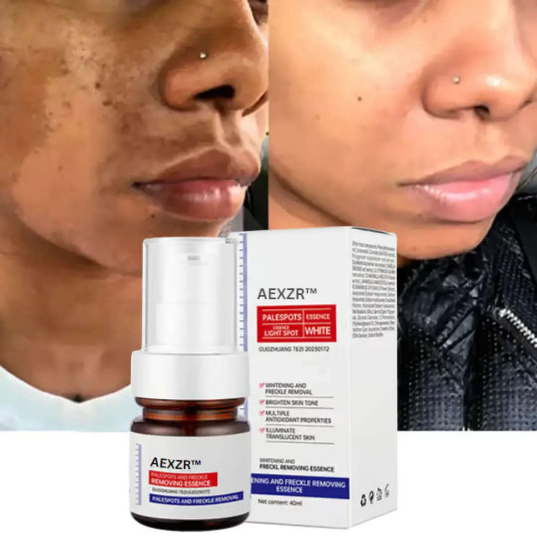 Vitamin C Whitening Freckles Face Cream Remove Melasma Dark Spots Lighten Melanin - Image 8