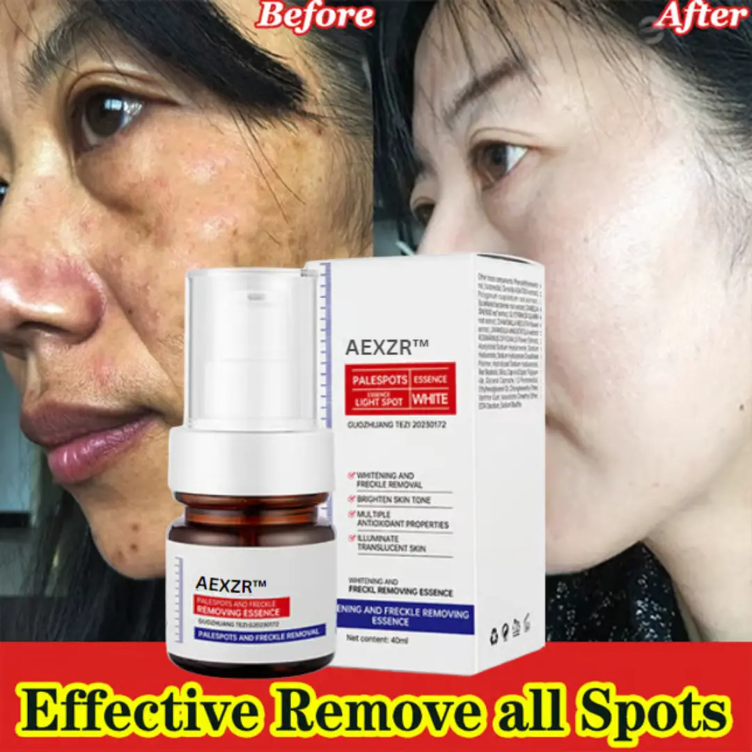 Vitamin C Whitening Freckles Face Cream Remove Melasma Dark Spots Lighten Melanin - Image 9